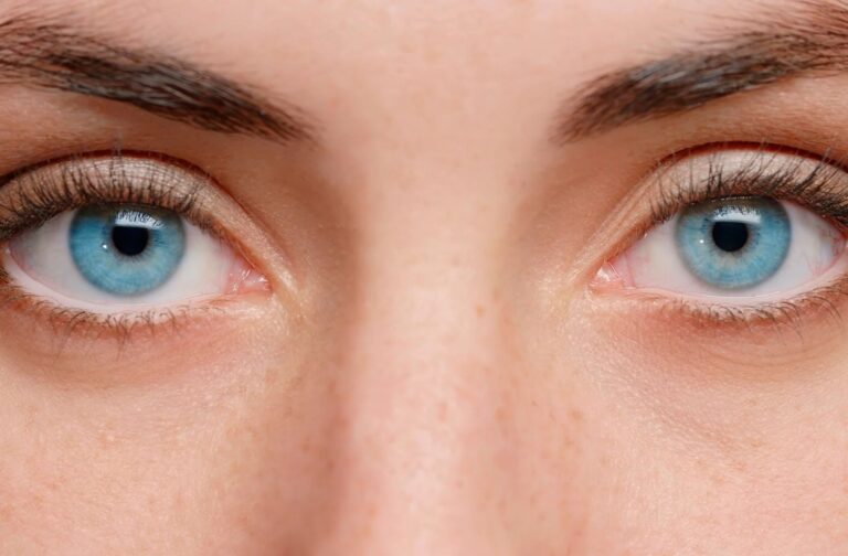 Are-Blue-Eyes-More-Sensitive-to-Sunlight-Hero